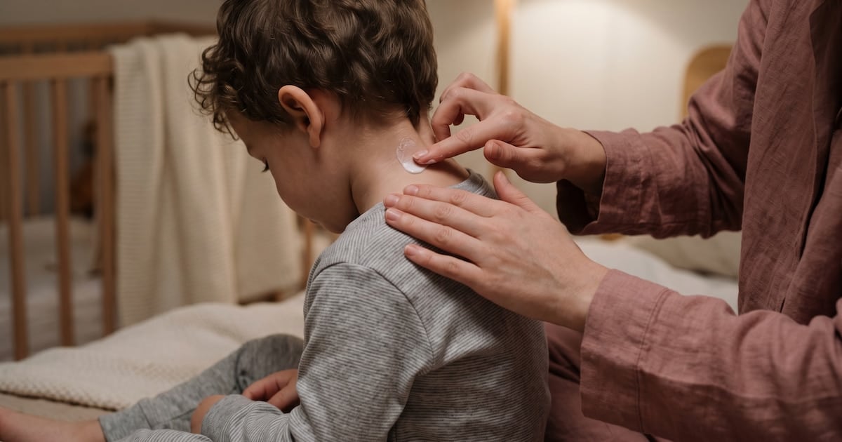 Dermatitis atópica: cuando la piel paga los platos rotos de la economía y el sueño se vuelve un bien escaso