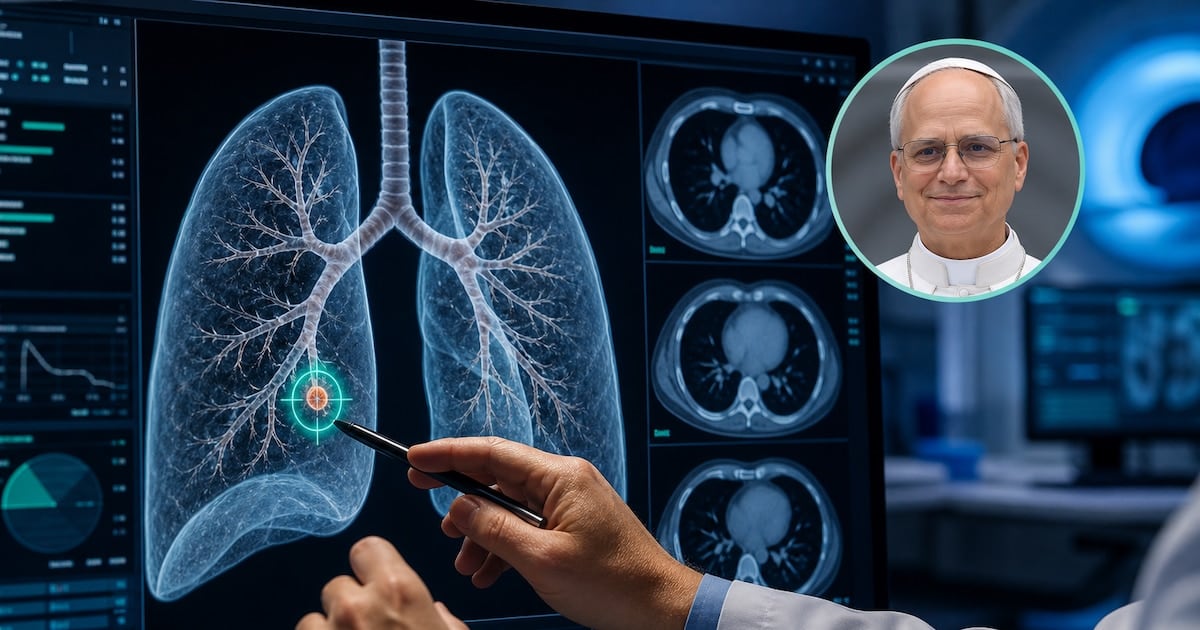 Nódulo pulmonar: por qué los médicos optan por operar una lesión diminuta antes de noviembre